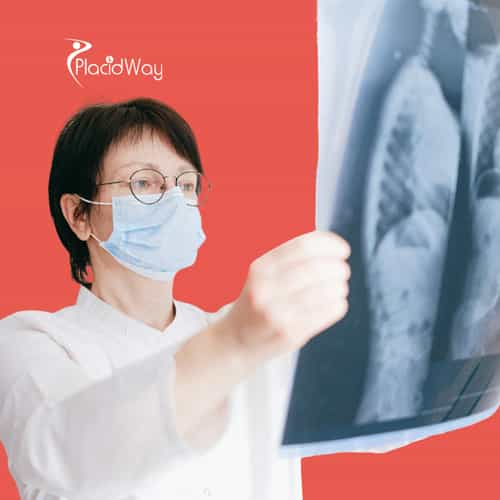 Innovative Immunotherapy Approaches for Lung Cancer: Trends from Mexican Cancer Centers